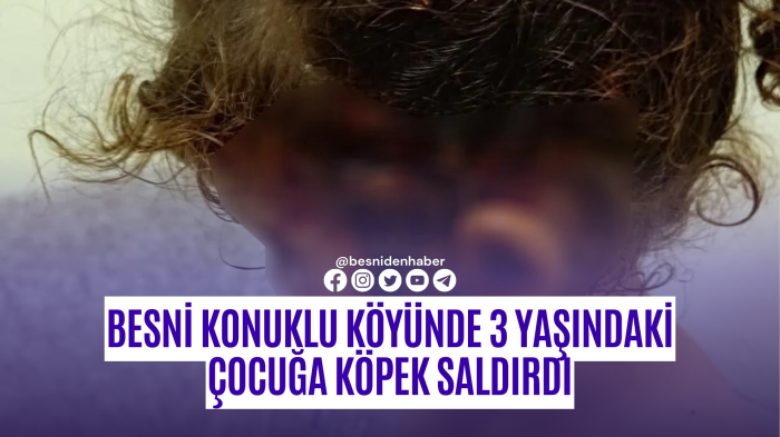 Besni Konuklu Köyünde 3 yaşındaki çocuğa köpek saldırdı