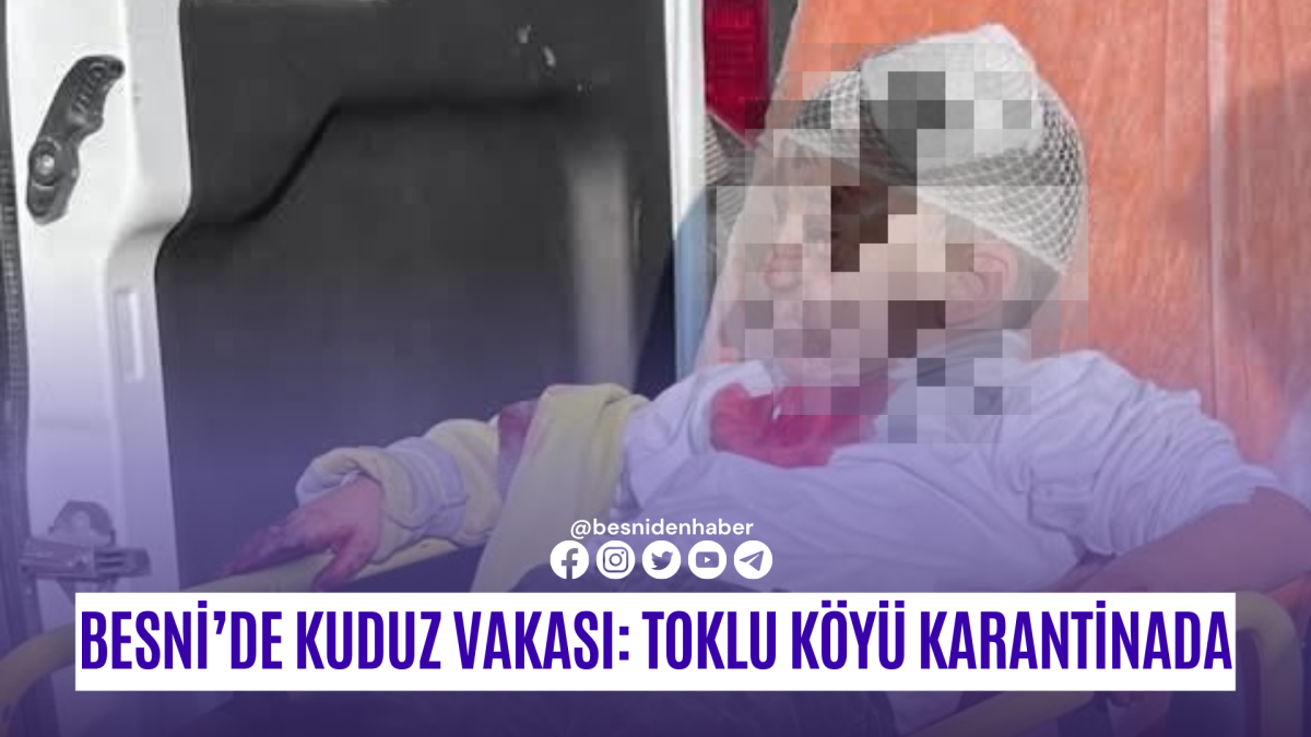 Besni’de Kuduz Vakası: Toklu Köyü Karantinada