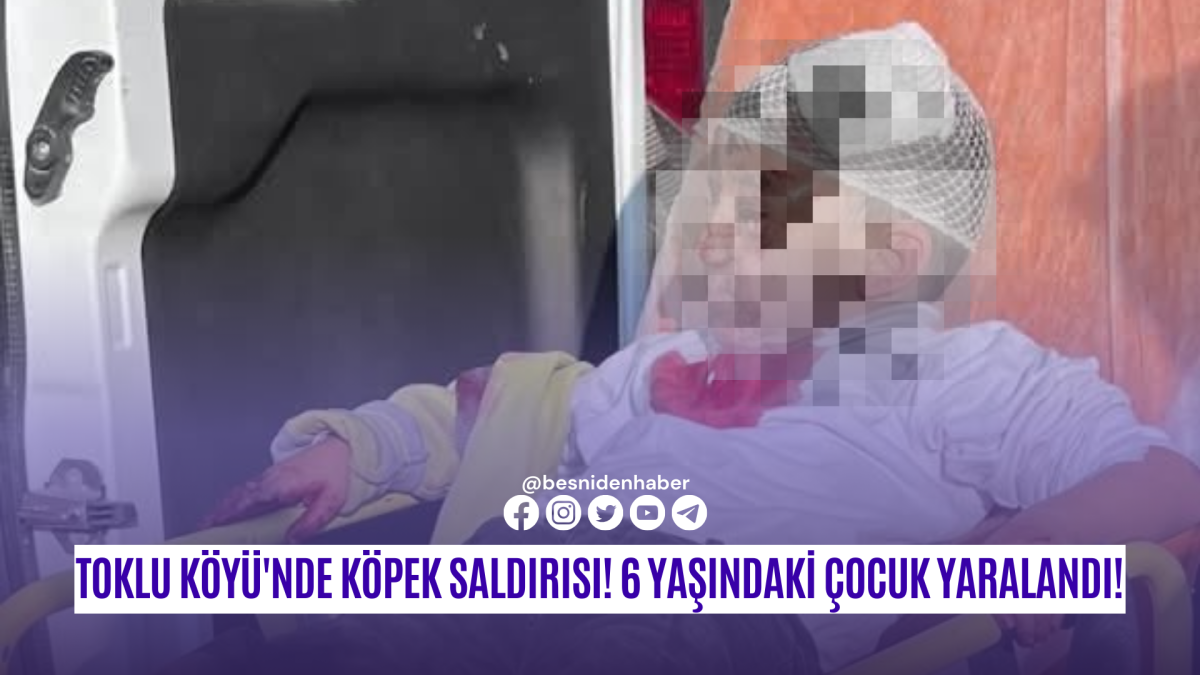 Toklu Köyü'nde Köpek Saldırısı! 6 Yaşındaki Çocuk Yaralandı